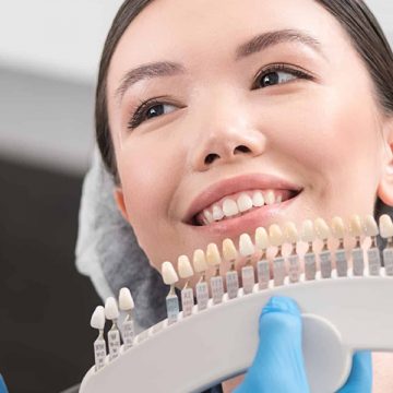How to Restore Your Smile Using Implant-Supported Dentures