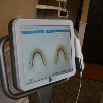 Concord Woods Dental gallery Image 16
