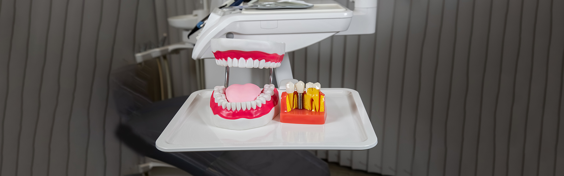 How Long Do Implant-Supported Dentures Last?