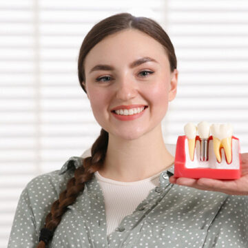 How to Choose the Right Dental Implant for Your Needs? – Comprehensive Guide