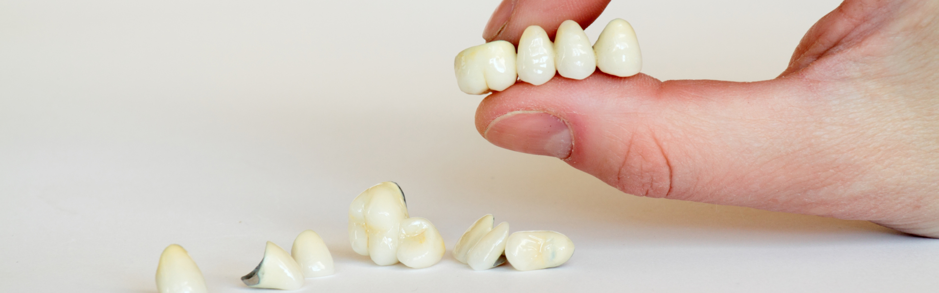 The Ultimate Guide to All-Porcelain Dental Crowns - Enhancing Smiles with Natural-Looking, Durable Restorations