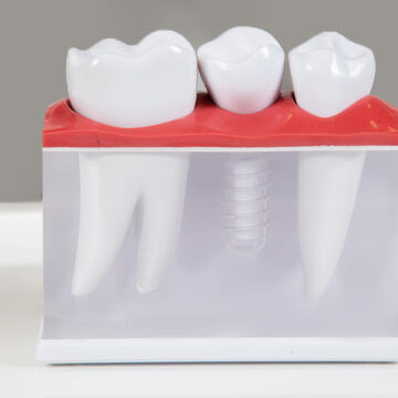 Are diseased gums a problem when getting dental implants?