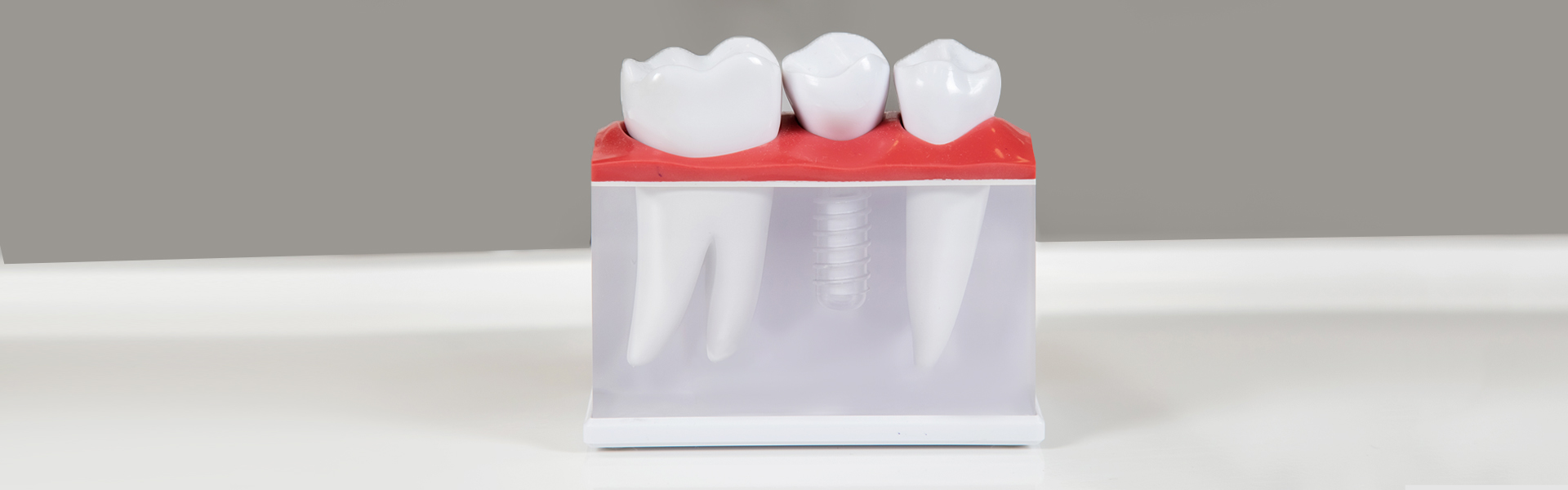 Are diseased gums a problem when getting dental implants?