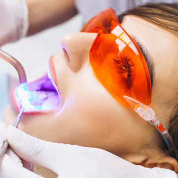 CAN I WHITEN MY TEETH IF I HAVE COSMETIC WORK?