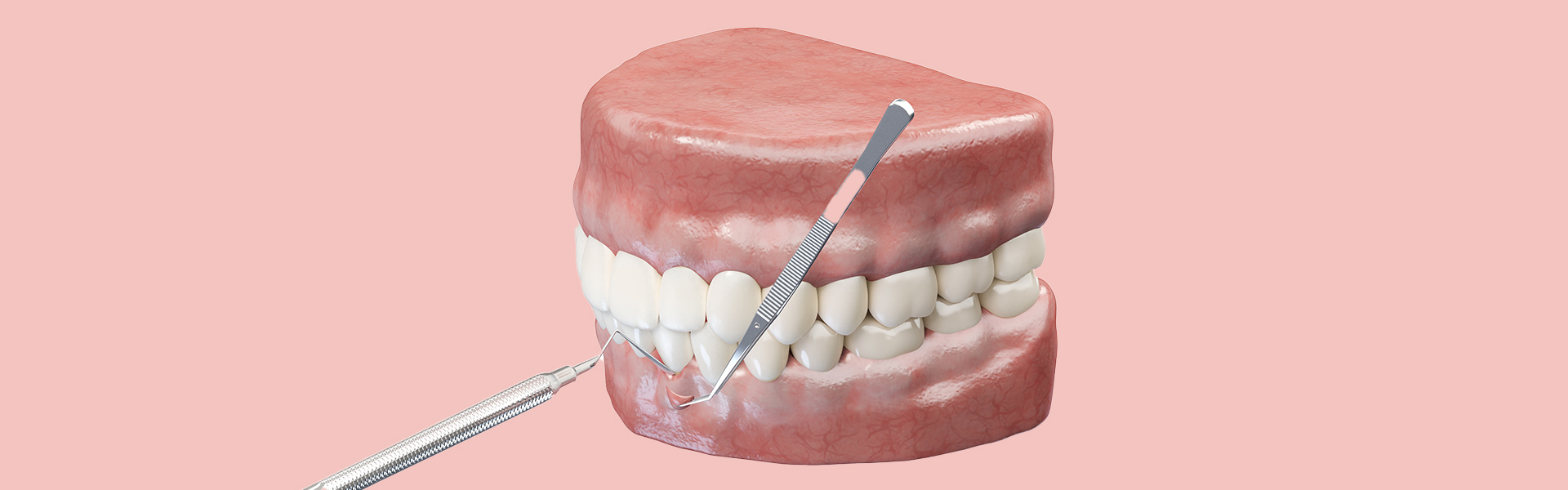 What Is Gum Reshaping and How Can It Improve Your Smile?