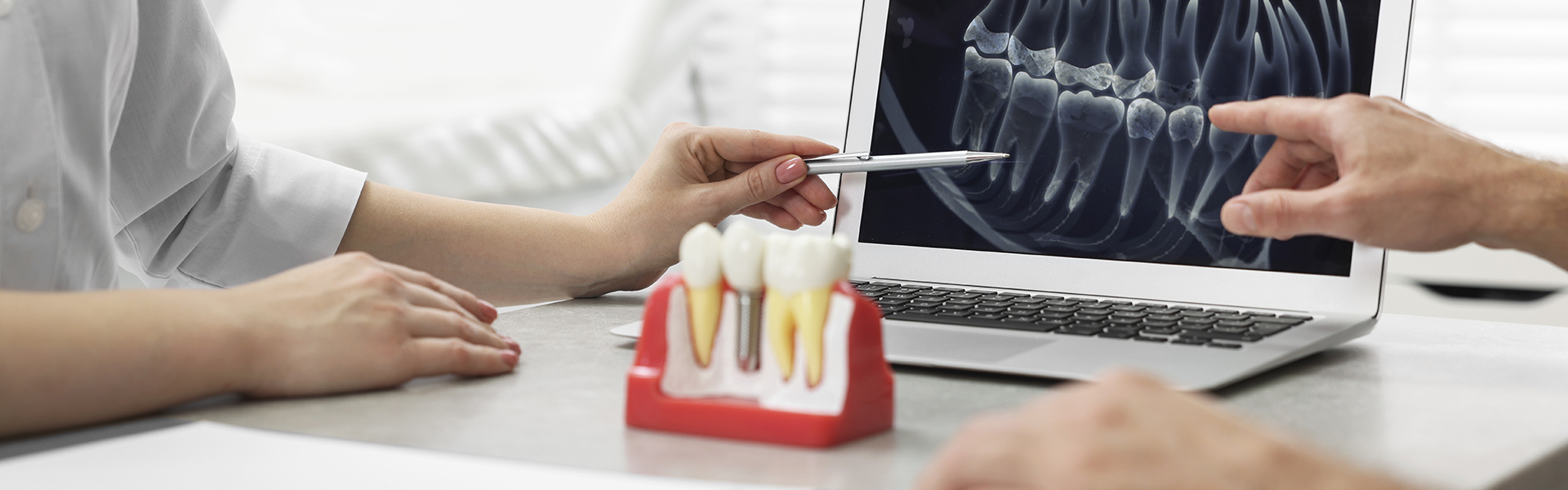 Dental Implants Across Age Groups: What You Need to Know