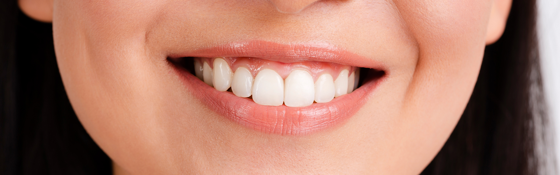 Teeth Straightening Options: Finding the Best Solution for a Perfect Smile